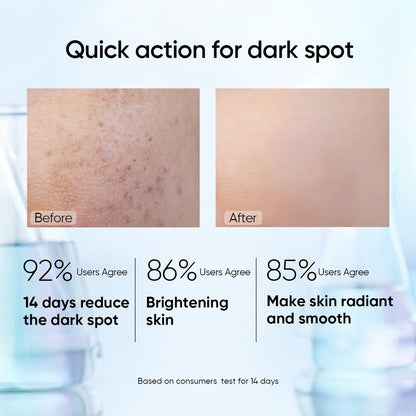 Skintific Symwhite 377 Dark Spot Serum
