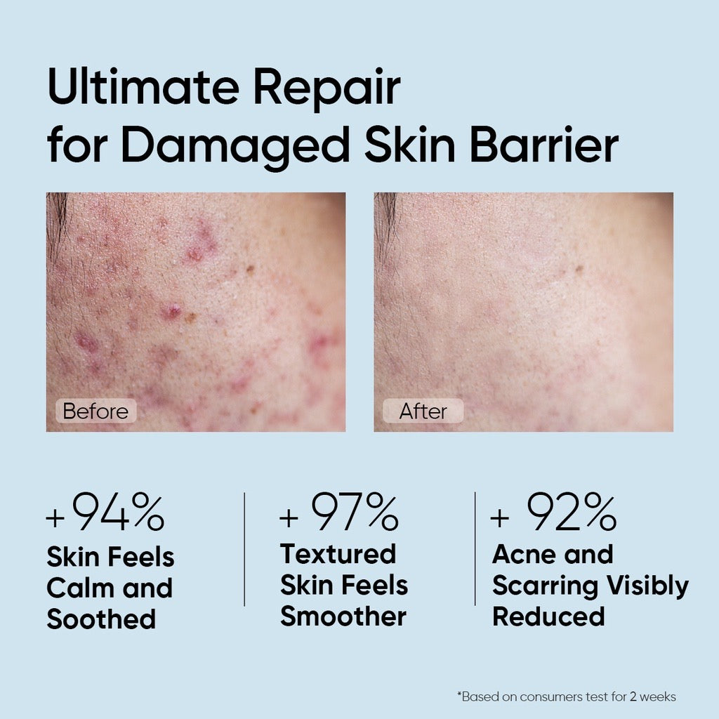 Skintific 5X Ceramide Barrier Repair Serum
